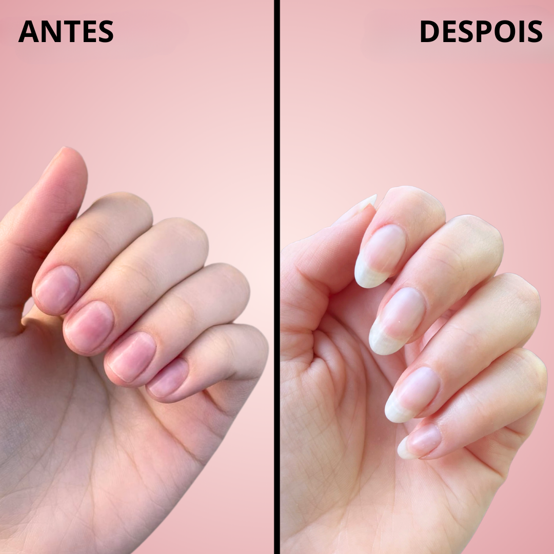 Sérum Fortalecedor de Uñas con Aceite Nutritivo (OFERTA 2X1)