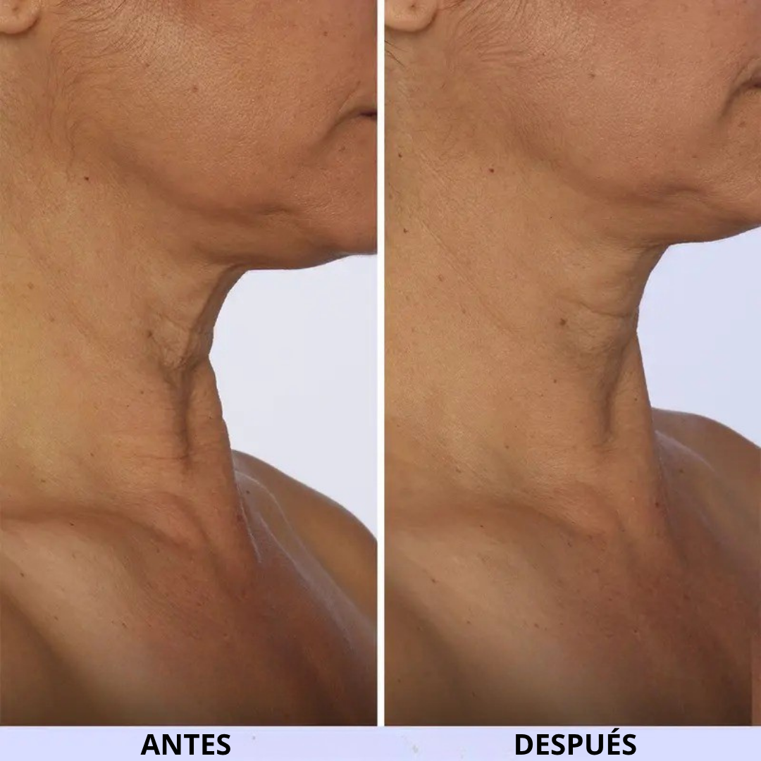 Crema reafirmante e hidratante para cuello