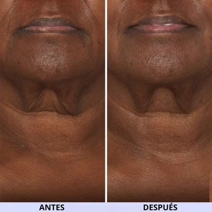 Crema reafirmante e hidratante para cuello