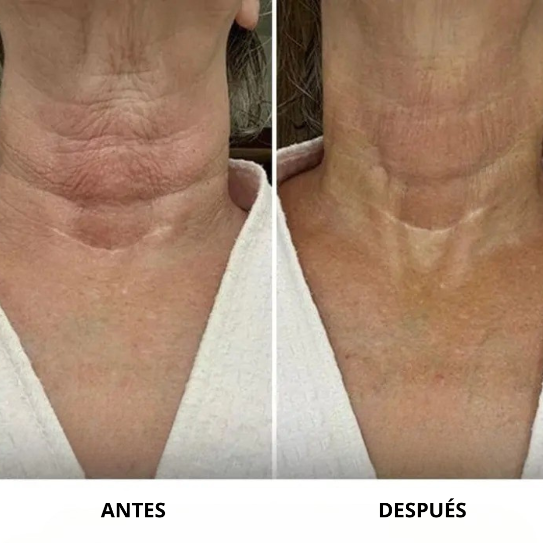 Crema reafirmante e hidratante para cuello