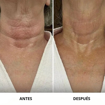 Crema reafirmante e hidratante para cuello
