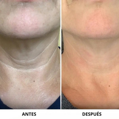 Crema reafirmante e hidratante para cuello